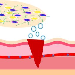 {{brizy_dc_image_alt entityId=